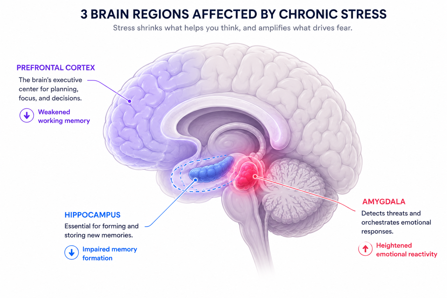 Brain diagram showing how chronic stress shrinks the hippocampus, weakens the prefrontal cortex, and enlarges the amygdala, explaining why stress impairs everyday memory while strengthening emotional memories.